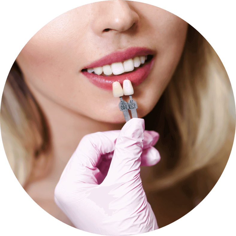 dental patient undergoing veneers procedure