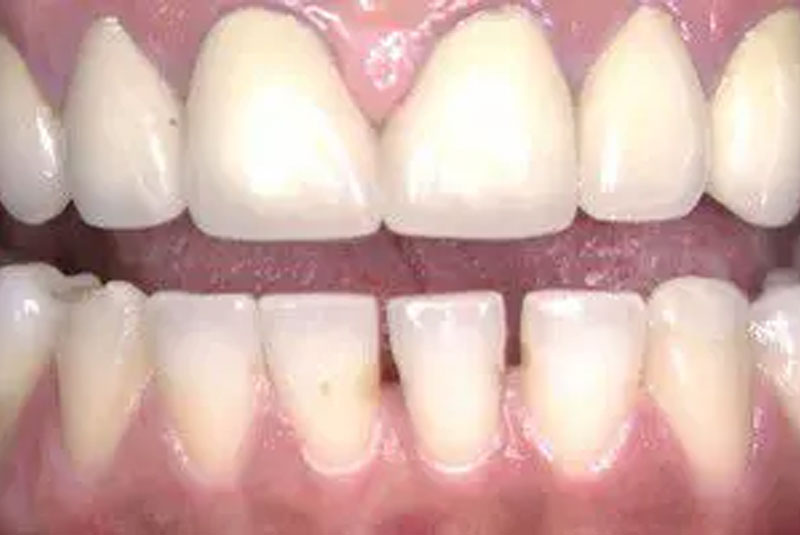Before