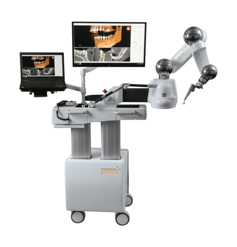 Yomi Robotic Surgery Concord, CA Smile Makers Dental Care